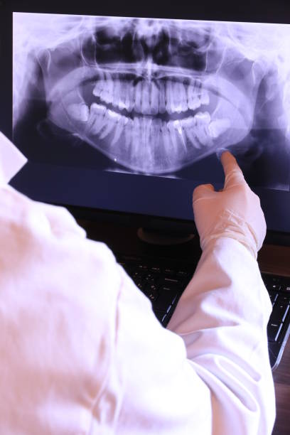 Best Emergency Broken Tooth Repair in Gold River, CA