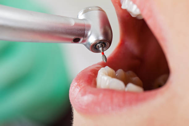 Best Walk-In Emergency Dentist in Gold River, CA